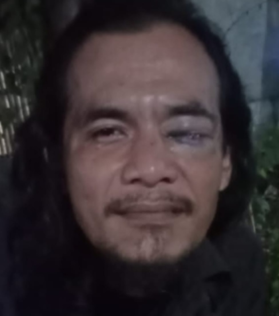 Ketua DPC PWRI Kota Bekasi, Mengecam Aksi Pengeroyokan Wartawan; Ini Bentuk Pencideraan Kebebasan Pers